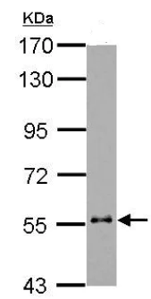 Western blot - Anti-KRT6B antibody (AB154313)