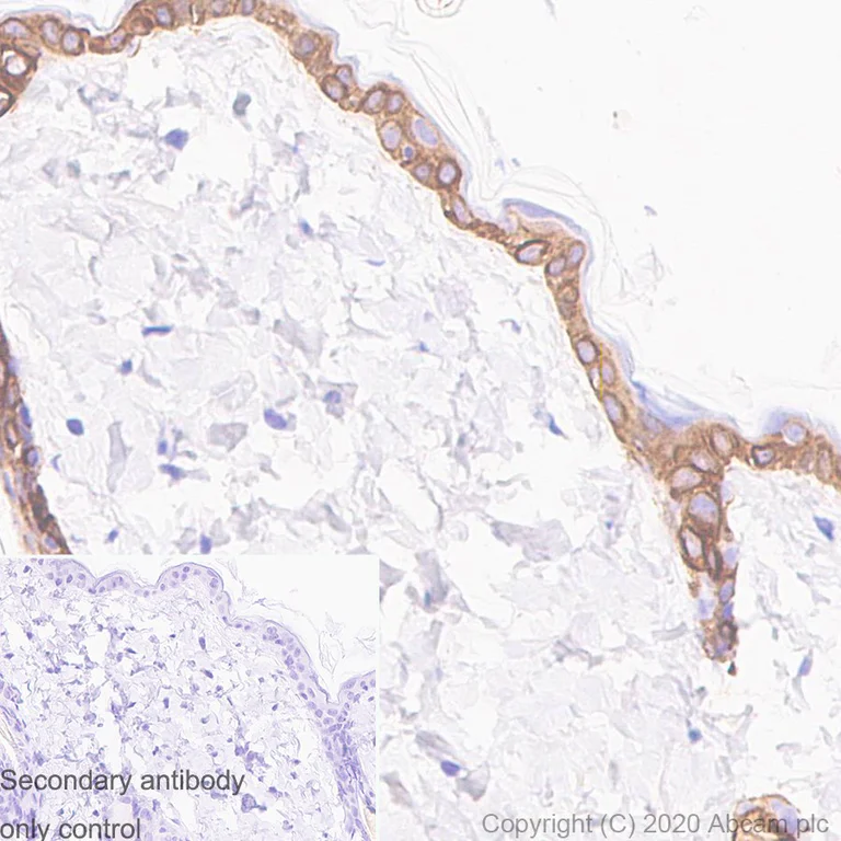Immunohistochemistry (Formalin/PFA-fixed paraffin-embedded sections) - Anti-KRT6C antibody [SP87] (AB227643)