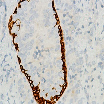 Immunohistochemistry (Formalin/PFA-fixed paraffin-embedded sections) - Anti-KRT6C antibody [SP87] (AB227643)