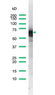 Western blot - Anti-KRT6C antibody [SP87] (AB227643)