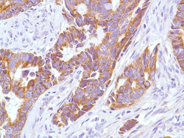 Immunohistochemistry (Formalin/PFA-fixed paraffin-embedded sections) - Anti-KRT6C antibody [SP87] - BSA and Azide free (ab240985), expandable thumbnail