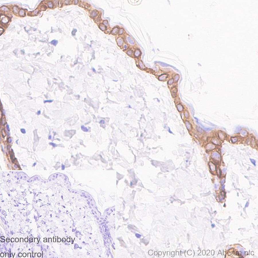 Immunohistochemistry (Formalin/PFA-fixed paraffin-embedded sections) - Anti-KRT6C antibody [SP87] - BSA and Azide free (AB240985), expandable thumbnail