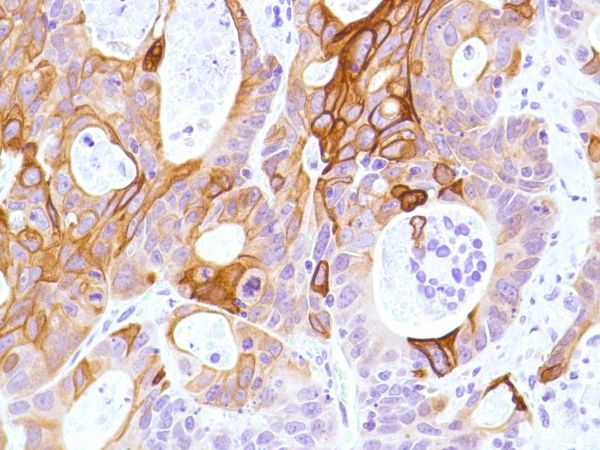 Immunohistochemistry (Formalin/PFA-fixed paraffin-embedded sections) - Anti-KRT6C antibody [SP87] - BSA and Azide free (ab240985), expandable thumbnail