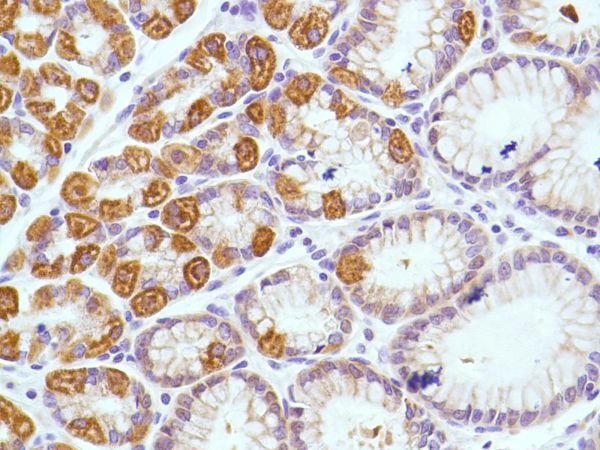 Immunohistochemistry (Formalin/PFA-fixed paraffin-embedded sections) - Anti-KRT6C antibody [SP87] - BSA and Azide free (ab240985), expandable thumbnail
