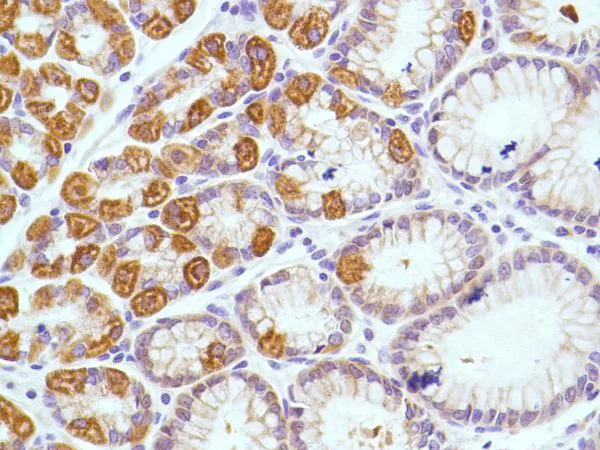 Immunohistochemistry (Formalin/PFA-fixed paraffin-embedded sections) - Anti-KRT6C antibody [SP87] - BSA and Azide free (AB240985)