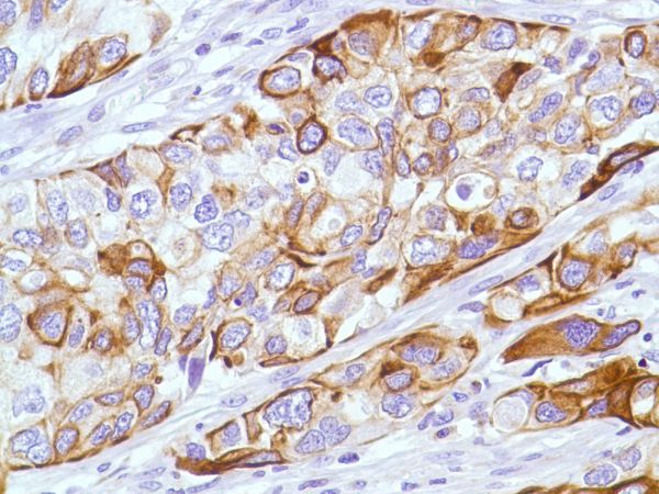 Immunohistochemistry (Formalin/PFA-fixed paraffin-embedded sections) - Anti-KRT6C antibody [SP87] - BSA and Azide free (ab240985), expandable thumbnail