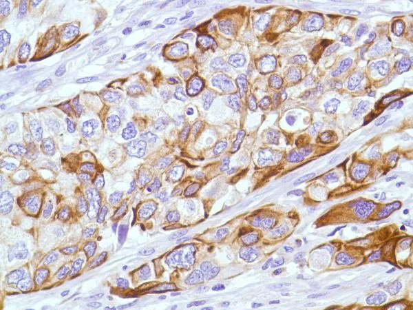 Immunohistochemistry (Formalin/PFA-fixed paraffin-embedded sections) - Anti-KRT6C antibody [SP87] - BSA and Azide free (AB240985)