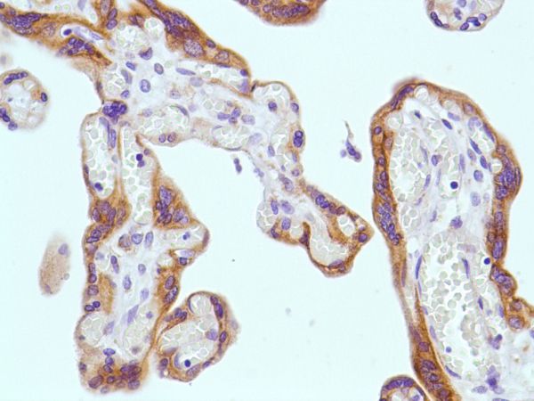 Immunohistochemistry (Formalin/PFA-fixed paraffin-embedded sections) - Anti-KRT6C antibody [SP87] - BSA and Azide free (ab240985), expandable thumbnail