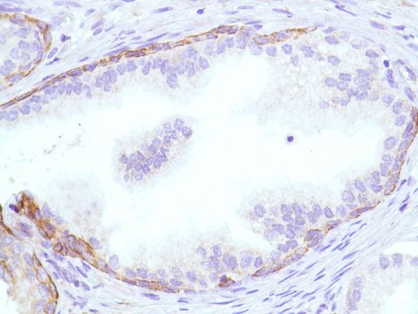 Immunohistochemistry (Formalin/PFA-fixed paraffin-embedded sections) - Anti-KRT6C antibody [SP87] - BSA and Azide free (ab240985), expandable thumbnail