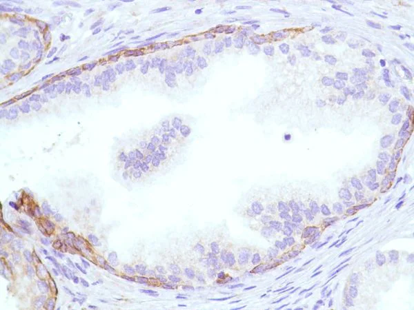 Immunohistochemistry (Formalin/PFA-fixed paraffin-embedded sections) - Anti-KRT6C antibody [SP87] - BSA and Azide free (AB240985)