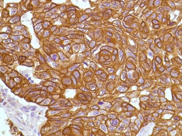 Immunohistochemistry (Formalin/PFA-fixed paraffin-embedded sections) - Anti-KRT6C antibody [SP87] - BSA and Azide free (ab240985), expandable thumbnail