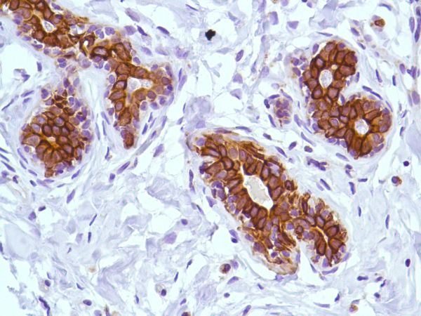 Immunohistochemistry (Formalin/PFA-fixed paraffin-embedded sections) - Anti-KRT6C antibody [SP87] - BSA and Azide free (ab240985), expandable thumbnail