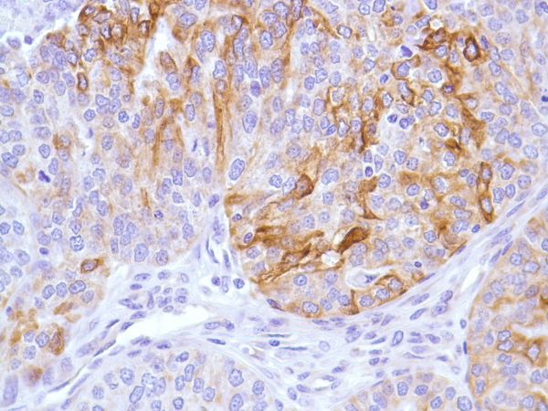 Immunohistochemistry (Formalin/PFA-fixed paraffin-embedded sections) - Anti-KRT6C antibody [SP87] - BSA and Azide free (ab240985), expandable thumbnail