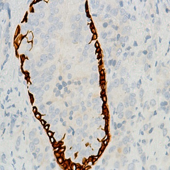 Immunohistochemistry (Formalin/PFA-fixed paraffin-embedded sections) - Anti-KRT6C antibody [SP87] - BSA and Azide free (ab240985), expandable thumbnail