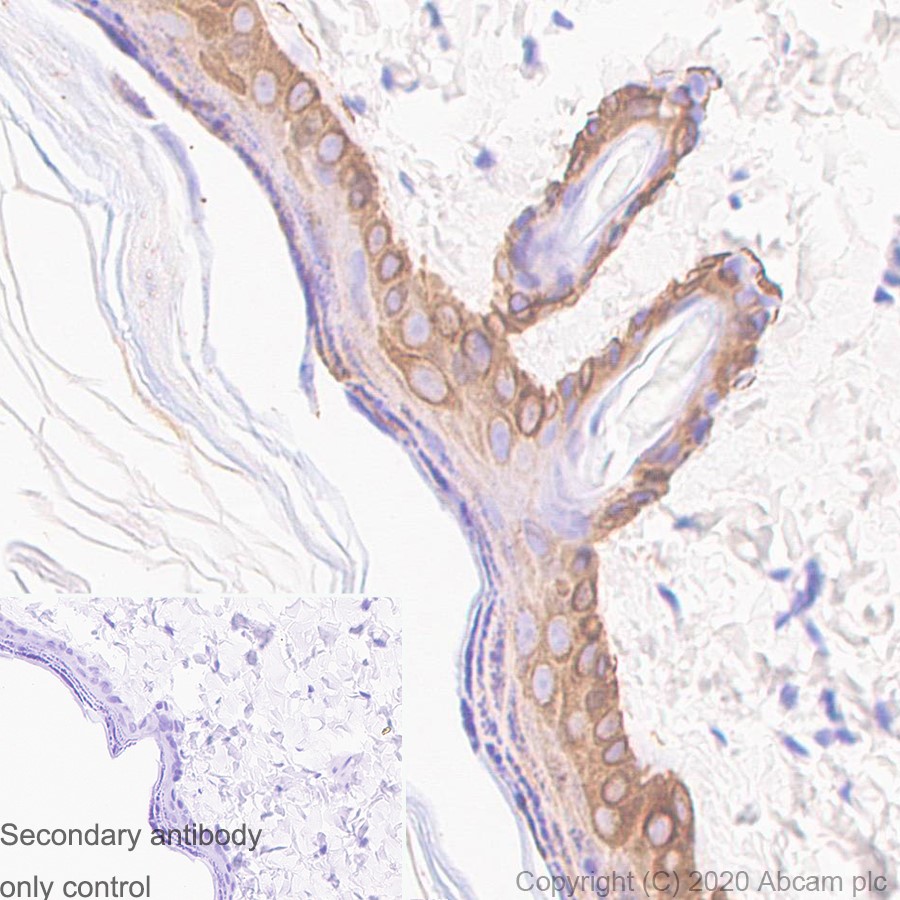 Immunohistochemistry (Formalin/PFA-fixed paraffin-embedded sections) - Anti-KRT6C antibody [SP87] - BSA and Azide free (AB240985), expandable thumbnail