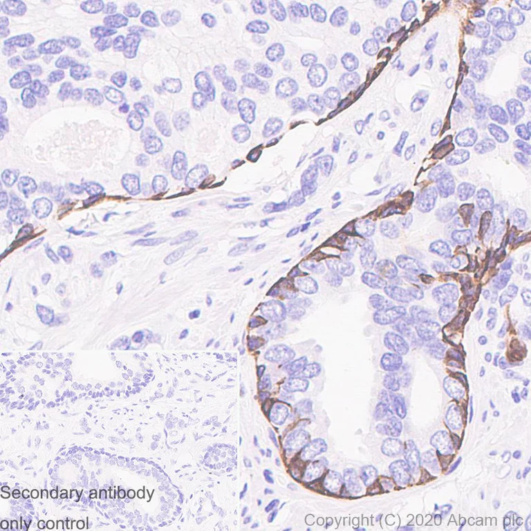 Immunohistochemistry (Formalin/PFA-fixed paraffin-embedded sections) - Anti-KRT6C antibody [SP87] - BSA and Azide free (AB240985)
