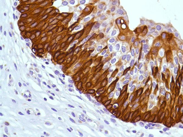 Immunohistochemistry (Formalin/PFA-fixed paraffin-embedded sections) - Anti-KRT6C antibody [SP87] - BSA and Azide free (ab240985), expandable thumbnail