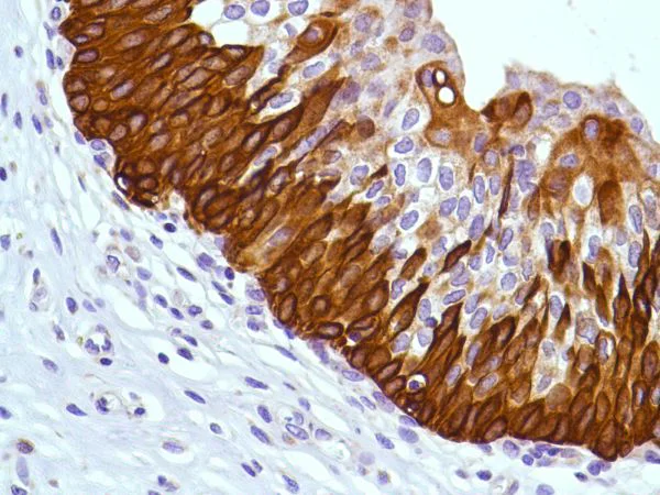 Immunohistochemistry (Formalin/PFA-fixed paraffin-embedded sections) - Anti-KRT6C antibody [SP87] - BSA and Azide free (AB240985)