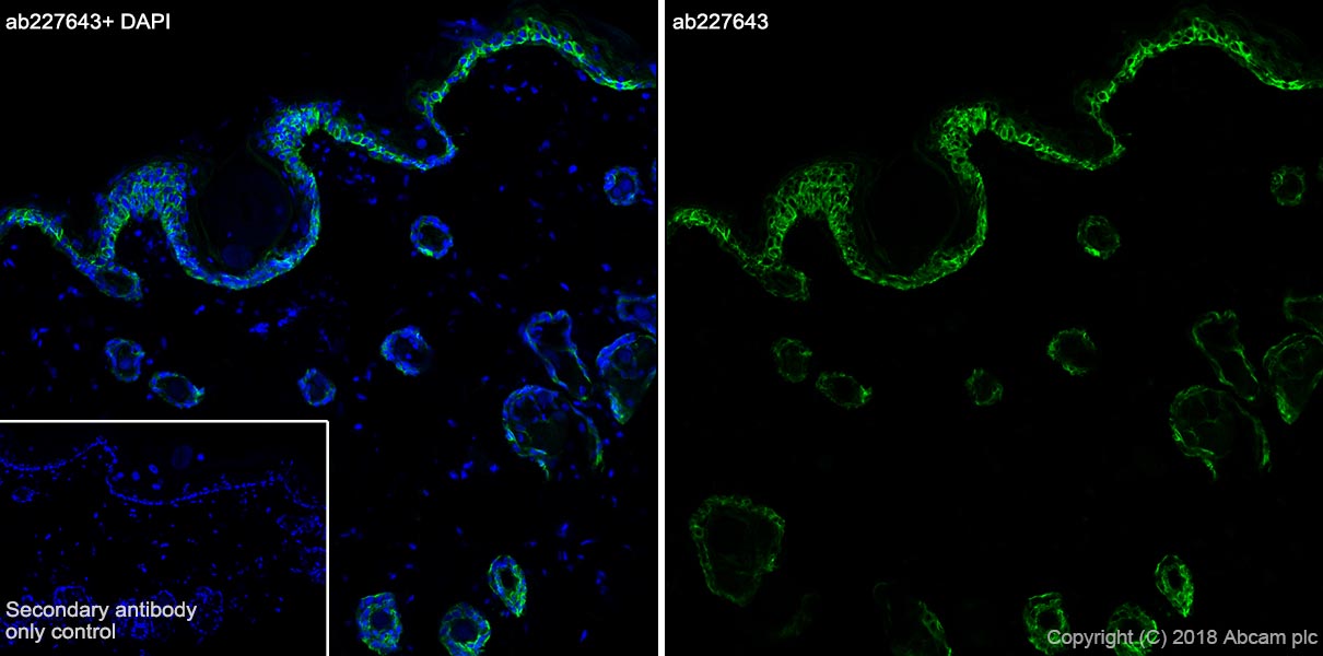 Immunohistochemistry (Frozen sections) - Anti-KRT6C antibody [SP87] - BSA and Azide free (ab240985), expandable thumbnail