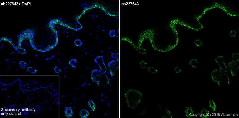 Immunohistochemistry (Frozen sections) - Anti-KRT6C antibody [SP87] - BSA and Azide free (AB240985)