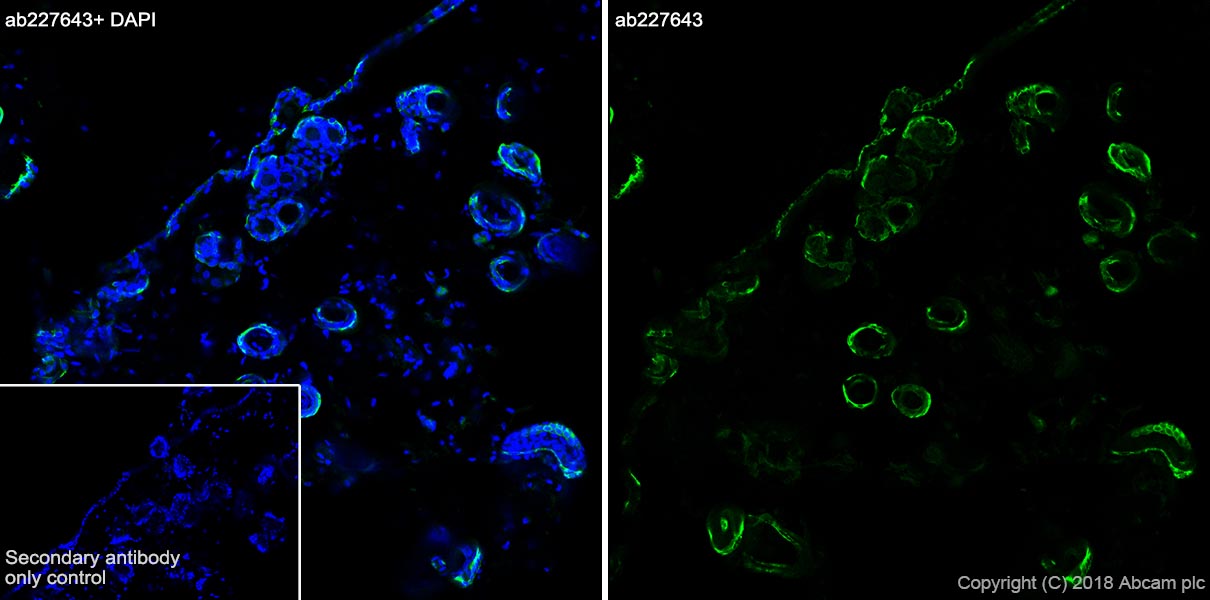 Immunohistochemistry (Frozen sections) - Anti-KRT6C antibody [SP87] - BSA and Azide free (ab240985), expandable thumbnail