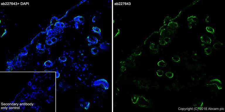 Immunohistochemistry (Frozen sections) - Anti-KRT6C antibody [SP87] - BSA and Azide free (AB240985)