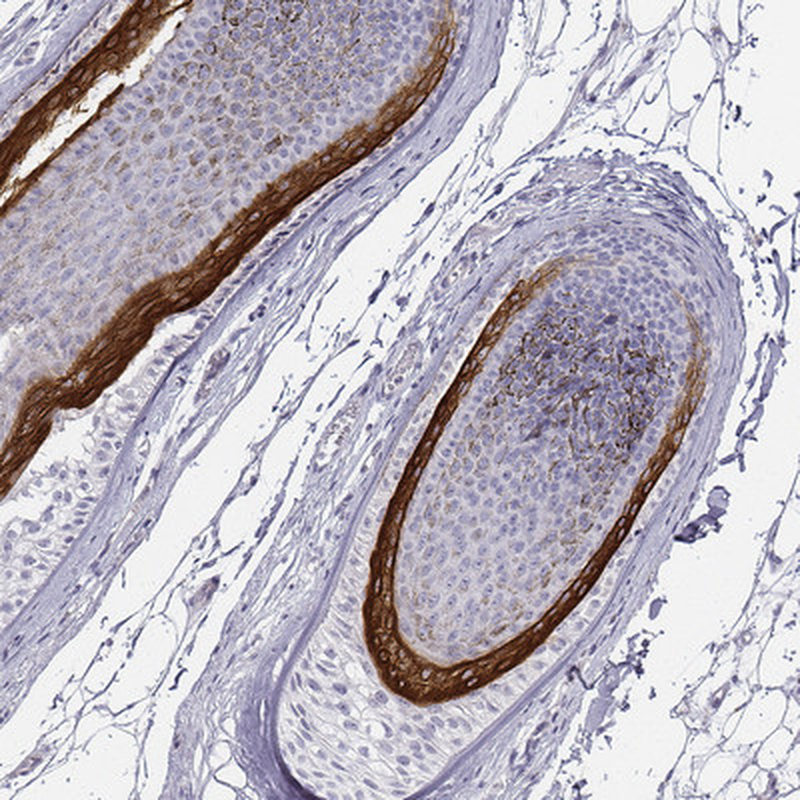Immunohistochemistry (Formalin/PFA-fixed paraffin-embedded sections) - Anti-KRT71 antibody (AB247090), expandable thumbnail