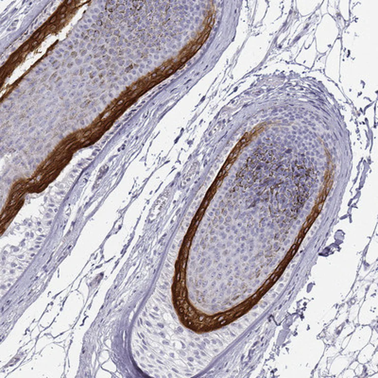 Immunohistochemistry (Formalin/PFA-fixed paraffin-embedded sections) - Anti-KRT71 antibody (AB247090)