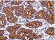 Immunohistochemistry (Formalin/PFA-fixed paraffin-embedded sections) - Anti-KRT72 antibody (AB127030)