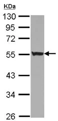 Western blot - Anti-KRT72 antibody (AB127030)