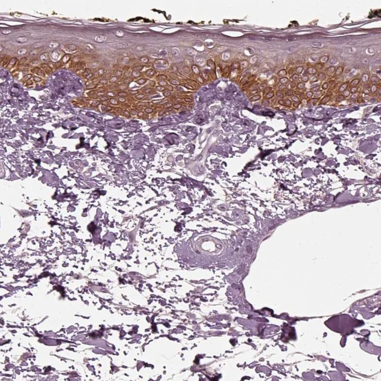 Immunohistochemistry (Formalin/PFA-fixed paraffin-embedded sections) - Anti-KRT79 antibody (AB254953)