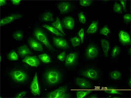 Immunocytochemistry/ Immunofluorescence - Anti-KRT81 antibody [3B10-5B10] (AB55407)