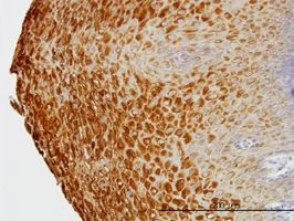 Immunohistochemistry (Formalin/PFA-fixed paraffin-embedded sections) - Anti-KRT81 antibody [3B10-5B10] (AB55407)