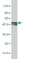 Western blot - Anti-KRT81 antibody [3B10-5B10] (AB55407)