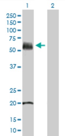 Western blot - Anti-KRT81 antibody (AB169303)