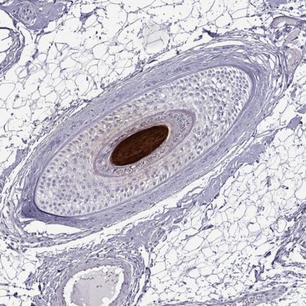 Immunohistochemistry (Formalin/PFA-fixed paraffin-embedded sections) - Anti-KRTAP11-1 antibody (AB222253)