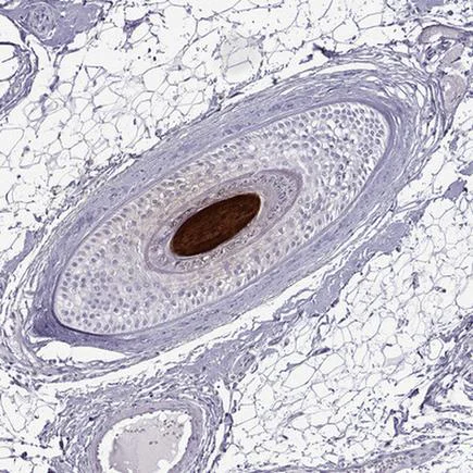 Immunohistochemistry (Formalin/PFA-fixed paraffin-embedded sections) - Anti-KRTAP11-1 antibody (AB222253)