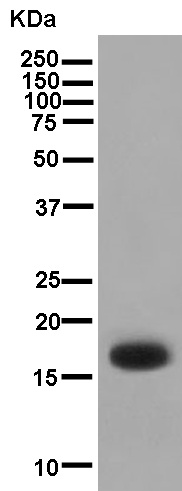 Western blot - Anti-KRTAP11-1 antibody [EPR13181] (AB181231)