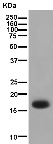 Western blot - Anti-KRTAP11-1 antibody [EPR13181] (AB181231)