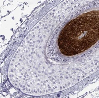Immunohistochemistry (Formalin/PFA-fixed paraffin-embedded sections) - Anti-KRTAP2-4 antibody (AB220937)