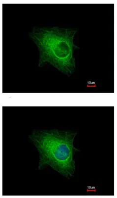 Immunocytochemistry/ Immunofluorescence - Anti-KRTHA3B antibody (AB154339)