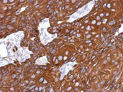 Immunohistochemistry (Formalin/PFA-fixed paraffin-embedded sections) - Anti-KRTHA3B antibody (AB154339)