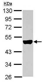 Western blot - Anti-KRTHA3B antibody (AB154339)