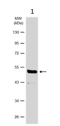 Western blot - Anti-KRTHA3B antibody (AB154339)