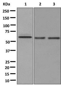Western blot - Anti-KRTHB3 antibody [EPR12333] (AB174272)