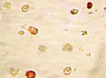 Immunocytochemistry - Anti-KSHV ORF45 antibody [2D4A5] (AB36618), expandable thumbnail