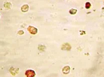 Immunocytochemistry - Anti-KSHV ORF45 antibody [2D4A5] (AB36618)