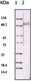 Western blot - Anti-KSHV ORF45 antibody [2D4A5] (AB36618), expandable thumbnail