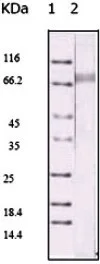 Western blot - Anti-KSHV ORF45 antibody [2D4A5] (AB36618)