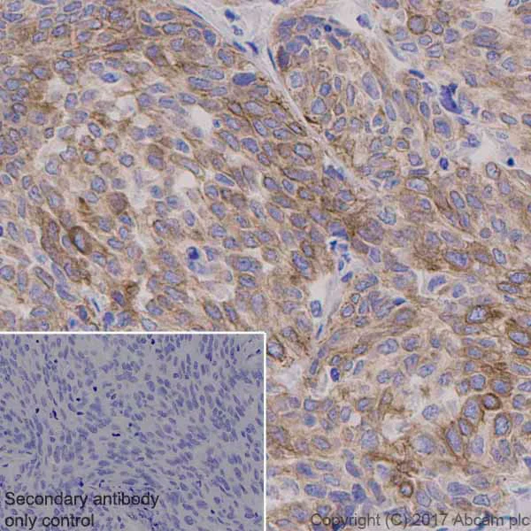 Immunohistochemistry (Formalin/PFA-fixed paraffin-embedded sections) - Anti-KSR1 antibody [EPR2421Y] (AB68483)